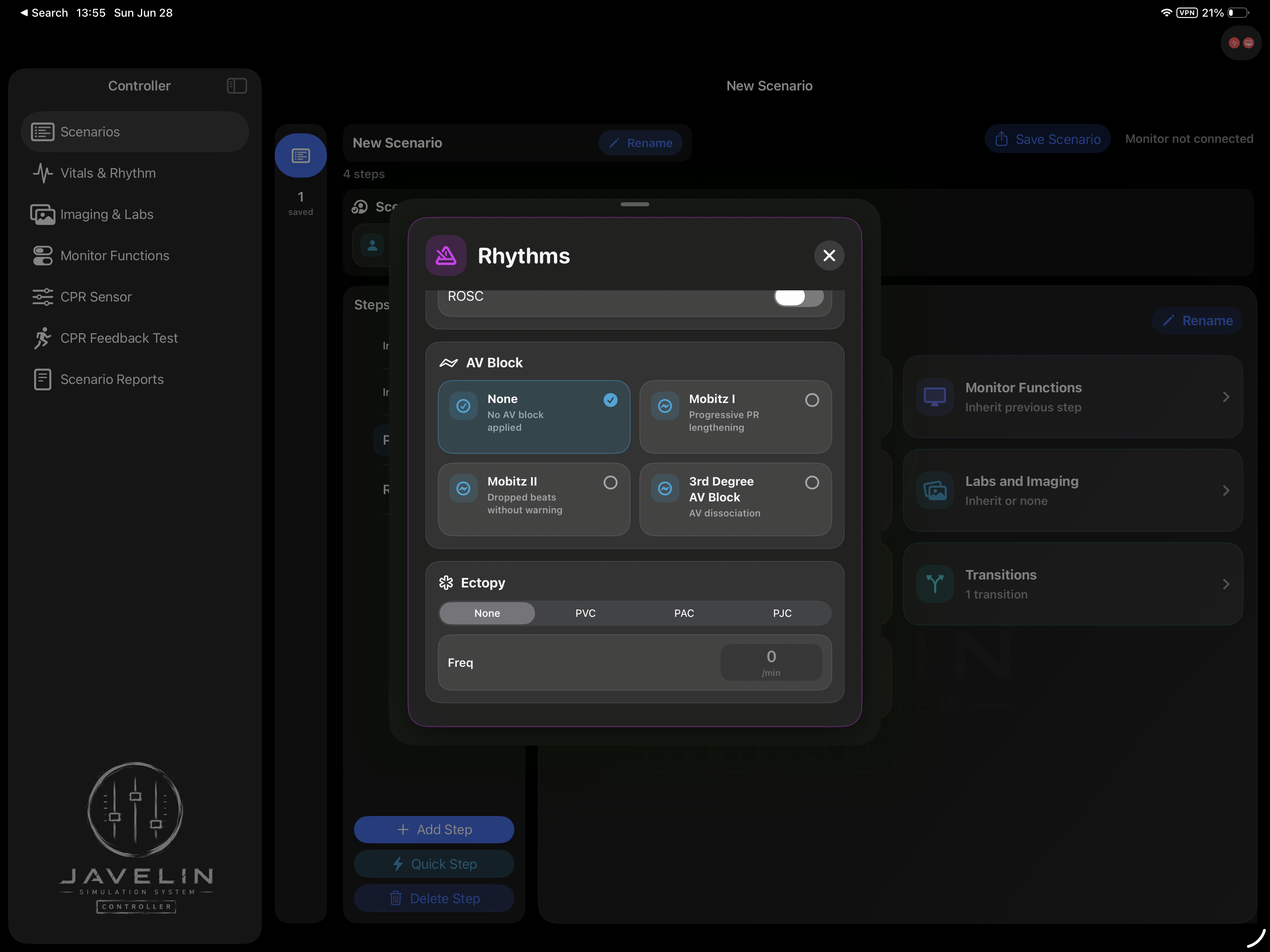 Rhythm settings panel with AV block choices