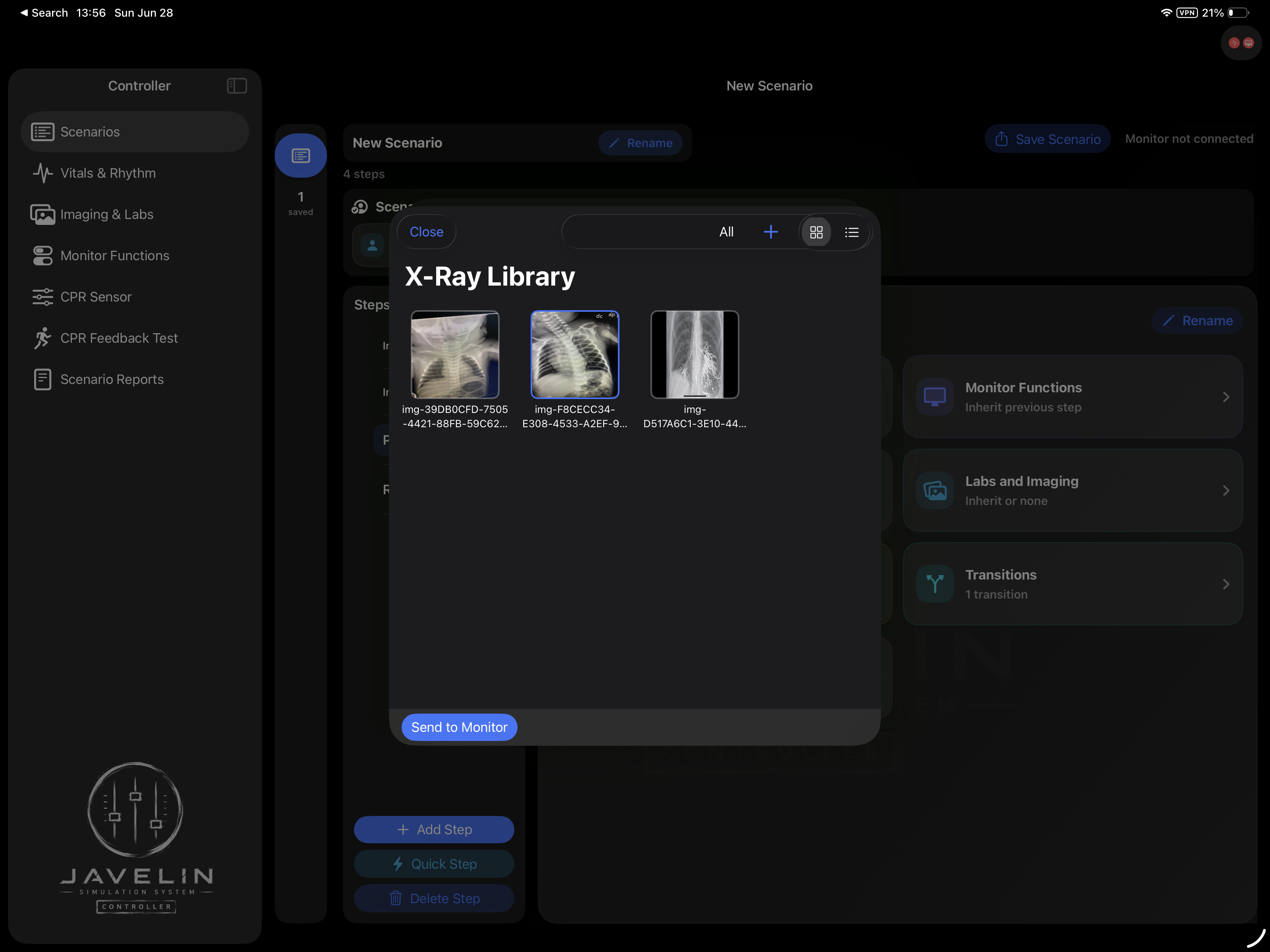 X-ray library with three imaging thumbnails